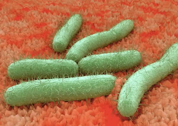 An image of E. Coli bacteria