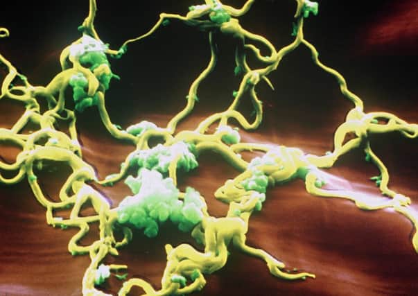 St Andrews team develops device which reduces time to test bacteria for resistance