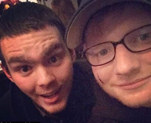 Ed sheeran shows the cut to his cheek inflicted by Princess Beatrice as she attempted to 'knight' James blunt at a private patry