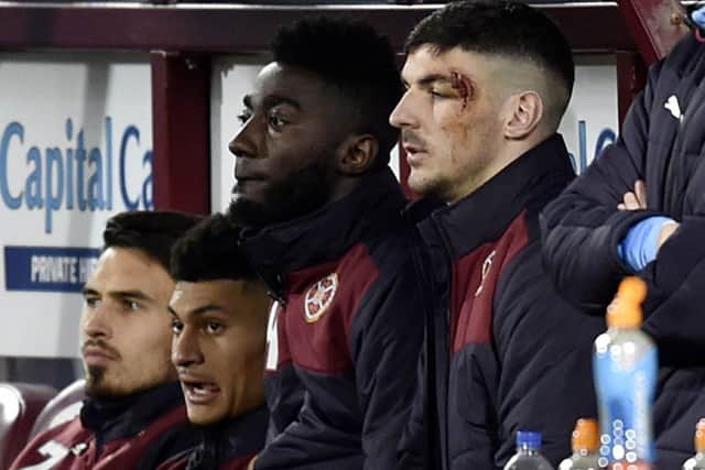 Callum Paterson sustained a head injury against Motherwell on Saturday. Picture: SNS