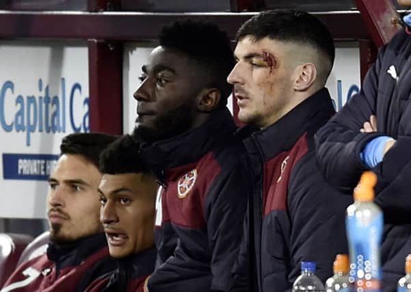 Callum Paterson sustained a head injury against Motherwell on Saturday. Picture: SNS