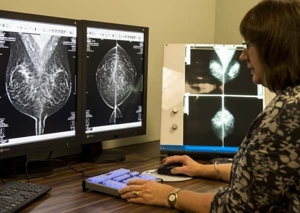 Nearly 4000 women were not sent a routine breast screening invitation