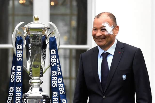 Eddie Jones sporting a plaster on his bruised eye at the RBS Six Nations launch at The Hurlingham Club in London. Picture: Stu Forster/Getty Images