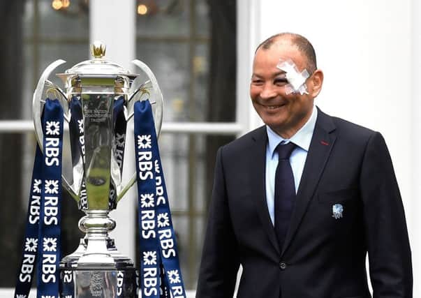 Eddie Jones sporting a plaster on his bruised eye at the RBS Six Nations launch at The Hurlingham Club in London.  Picture: Stu Forster/Getty Images