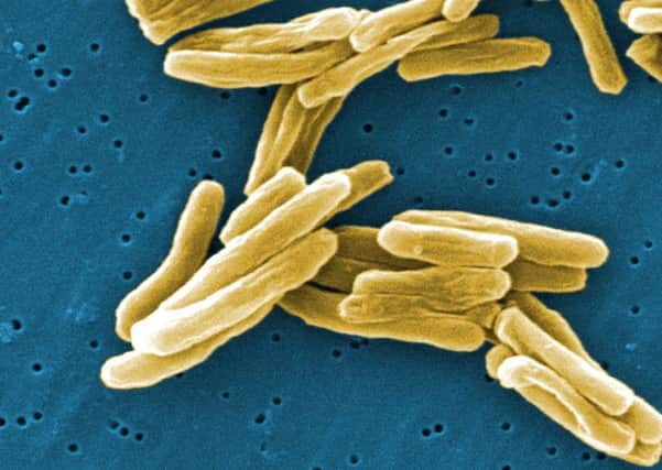 Discovery could help prevent the TB mycobacteria from mutating to create drug-resistant disease. Picture: PA
