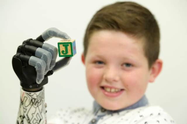 Touch Bionics are creating world-class work in Scotland