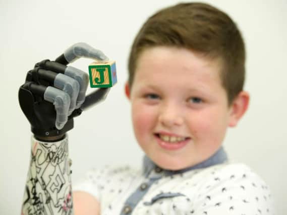 Touch Bionics are creating world-class work in Scotland