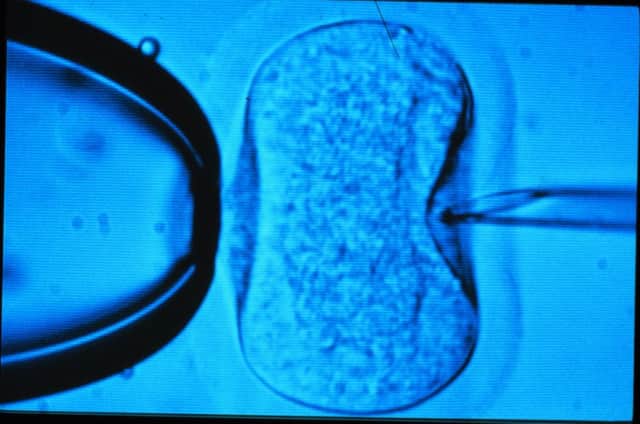 Eligible couples will have three rounds of IVF funded by the government (file photo)