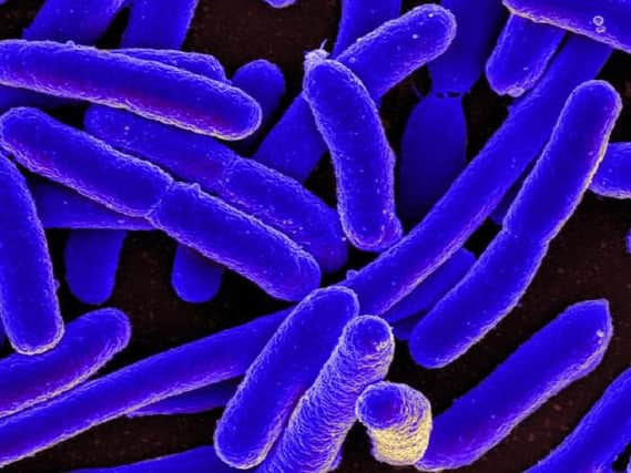 A Health Protection Scotland report has ruled that Dunsyre Blue was the source of the e.Coli outbreak last July.