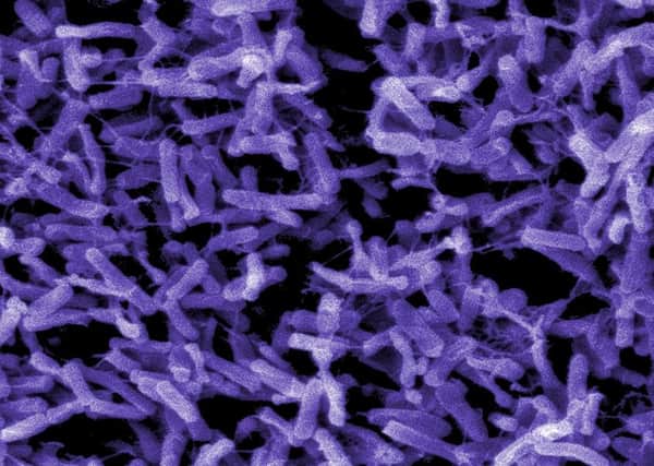 Electron micrograph of Clostridium difficile bacteria, which is costing NHS Scotland more than Â£8.5 million a year. Photograph: CDC/Phanie /Rex Features