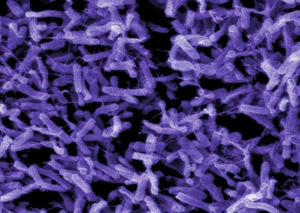 Electron micrograph of Clostridium difficile bacteria, which is costing NHS Scotland more than £8.5 million a year. Photograph: CDC/Phanie /Rex Features
