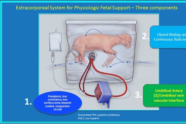 A graphic illustration of the "artificial womb" developed to support very premature babies. Picture: PA