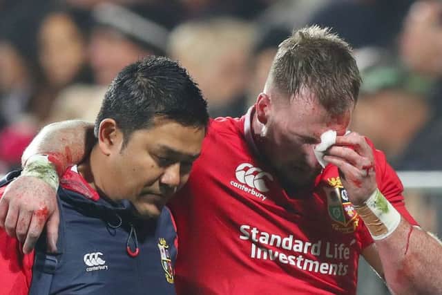 Scotland and Lions full-back Stuart Hogg leaves the field with a bloodied face after his collision with Conor Murray.