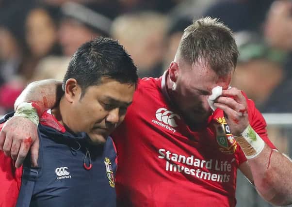 Scotland and Lions full-back Stuart Hogg leaves the field with a bloodied face after his collision with Conor Murray.