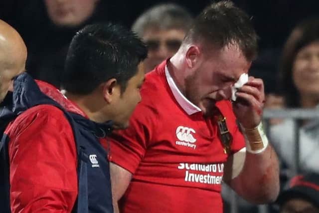 Stuart Hogg leaves the field with a facial injury in the Lions' win over Crusaders. Picture: David Rogers/Getty Images