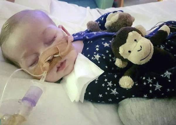 Charlie Gard died weeks befor his 1st birthday.