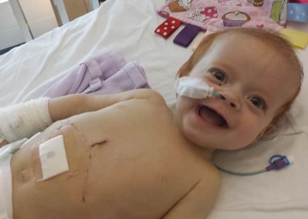 Ava Hainey after her liver transplant at 9 months old.