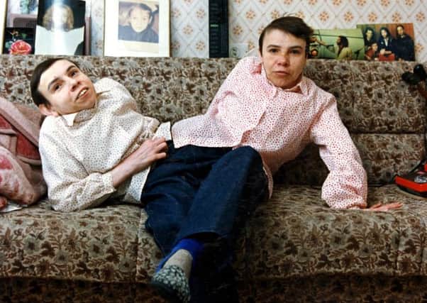 Masha, left, and Dasha Krivoshlyapova in 1994. They were taken from their mother at birth and subjected to medical experiments. Picture: Sipa Press/REX/Shutterstock