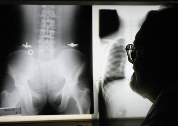 The camera would let doctors see inside the body without using expensive x-rays. Picture: AP