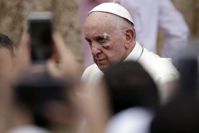 Pope Francis suffered a bruise to his cheek after falling in his Popemobile in Cartagena, Colombia. Picture: AP
