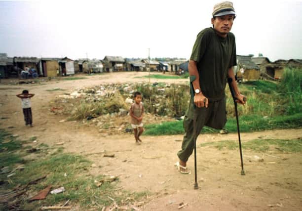 The new technique could be used to treat victims of land mines. Picture: AP