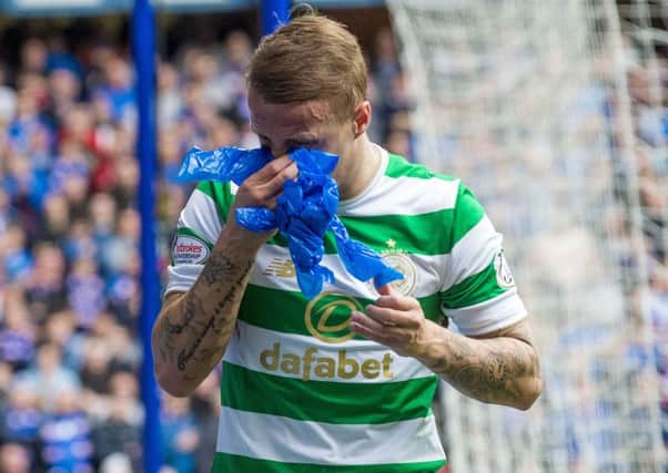 Celtic's Leigh Griffiths blowing his nose. Picture: SNS/Bill Murray