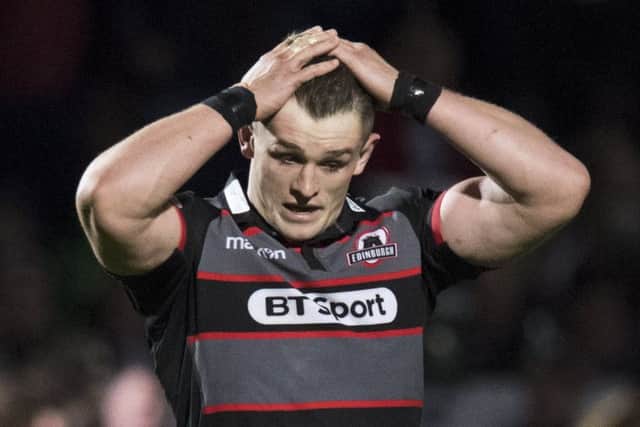Magnus Bradbury injured his head after falling on a night out. Pic: SNS
