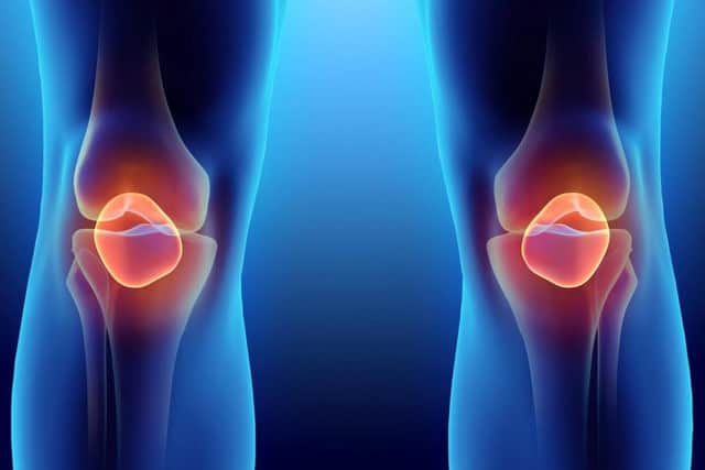 Ex-footballers at greater risk of knee replacement.