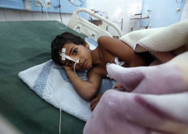 A Yemeni child suffering from diphtheria receives treatment at a hospital in the capital Sanaa.  (Picture: AFP/Getty Images)