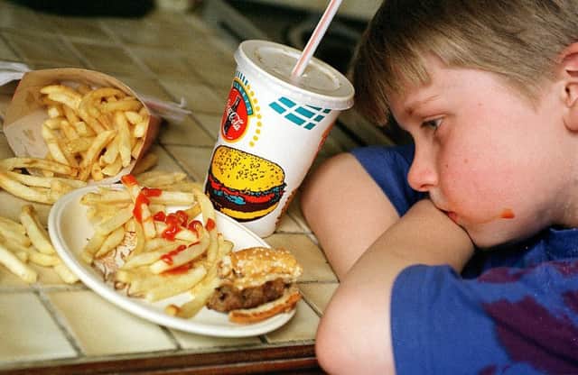 Children are being referred to weight specialists