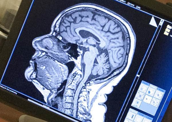 Researchers used functional MRI scans of young people with conduct disorder, as well as typically-developing teens, to analyse the amygdala and how it communicates with other parts of the brain. Picture: pennstatenews/Flickr