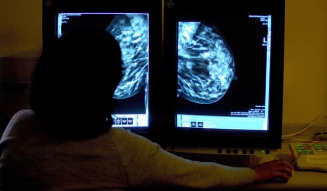 A consultant studies a mammogram in the search for breast cancer. Picture: Rui Vieira/PA Wire