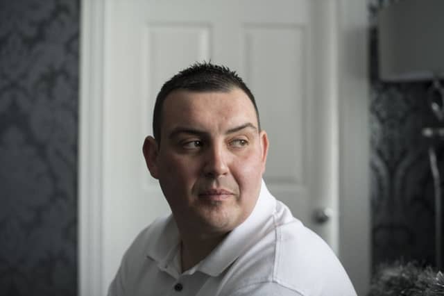 Heart failure patient Gerry Duff has the tiny transmitter in his chest. PIcture: John Devlin