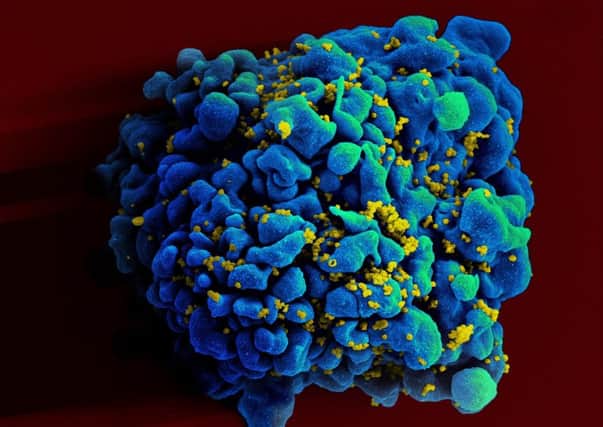 An HIV-infected H9 T-cell. Picture: NIAID/Wikimedia