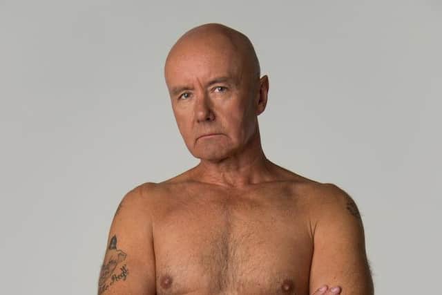Trainspotting author Irvine Welsh recently stripped down to his boxers to expose the naked truth about
prostate cancer. Picture: James Bennett