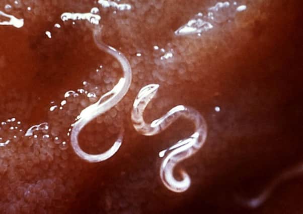 Hookworms penetrate the skin, are carried to the lungs, go through the respiratory tract to the mouth, are swallowed, and eventually reach the small intestine. (Picture: Centers for Disease Control)