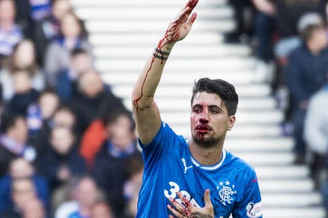 Rangers' Fabio Cardoso was left bloodied by Motherwell's Ryan Bowman. Picture: SNS/Craig Williamson
