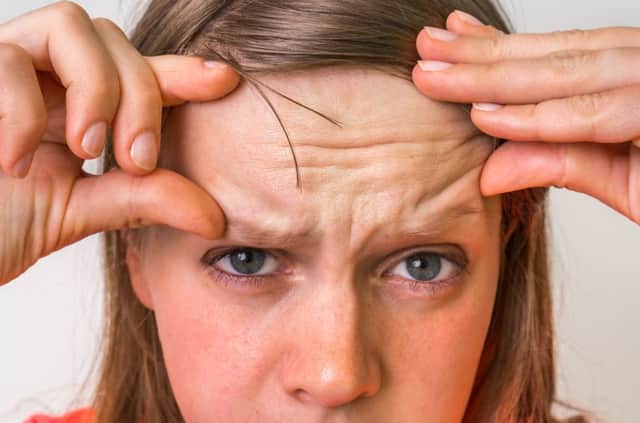 People who have more deep forehead wrinkles than is typical for their age may have a higher risk of dying of cardiovascular disease (CVD), researchers have suggested.