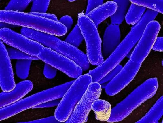 Tests have found the E.coli bug is present in more than one in ten private water supplies in Scotland.