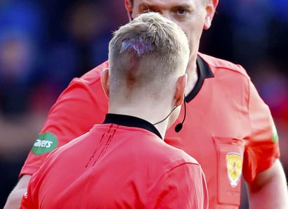 The back of assistant referee Calum Spence's head after receiving treatment for an injury. Picture: SNS