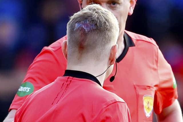The back of assistant referee Calum Spences head after receiving treatment for a head injury. Picture; SNS