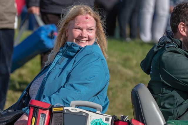 The injured spectator was able to smile but was left with a nasty head injury. Picture: Kenny Smith/PA