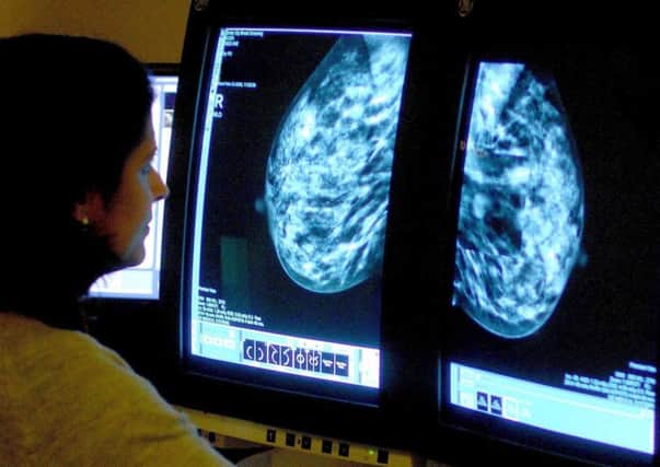 A consultant analyzing a mammogram. A study has found that women who are "larks" and at their best early in the morning are less likely to develop breast cancer than their night-owl sisters. Picture: Rui Vieira/PA Wire