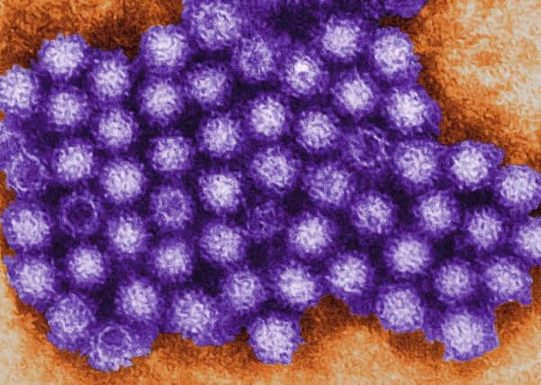 The Norovirus. Picture: Charles D. Humphrey/Centers for Disease Control and Prevention/PA Wire