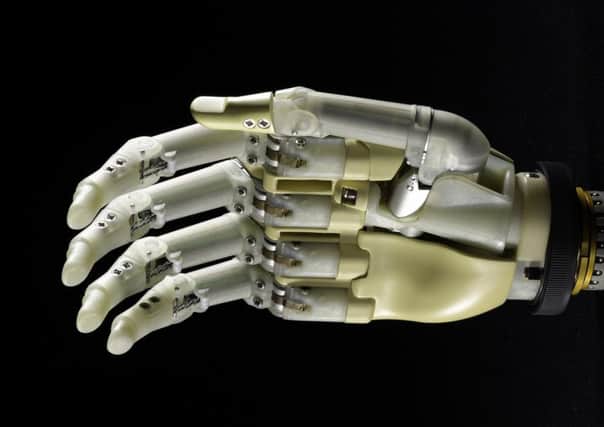 The bionic hand is an example of Scotlands culture of innovation, writes McKee. Picture: National Museums of Scotland