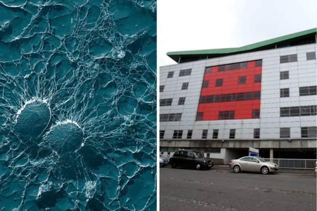 The rare strain of Staphylococcus aureus (left) affected infants at the Princess Royal Maternity Hospital in Glasgow and was described as very challenging by NHS bosses.