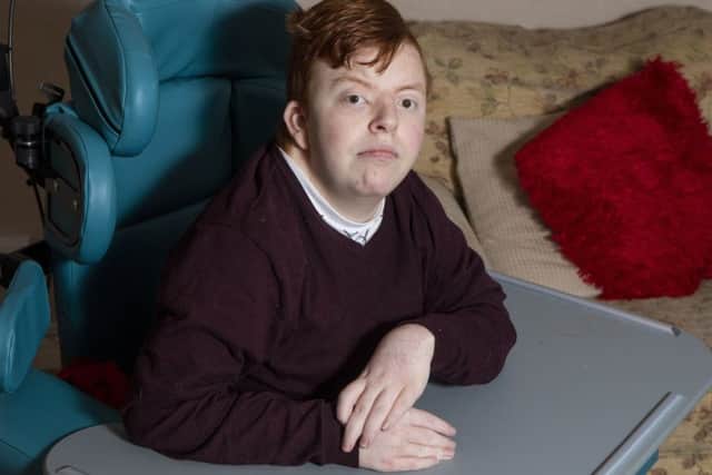 The Hibs fan, 22, was rushed to hospital where scans revealed he had suffered a stroke and had a bleed on the brain caused by a blood clot the size of a 10p coin. Picture: SWNS