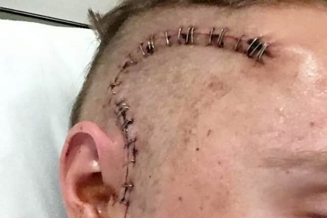 Craig Telfer, 27, said he was taking paracetamol for his agonising headaches before going to the GP who prescribed him with something stronger. Picture: SWNS