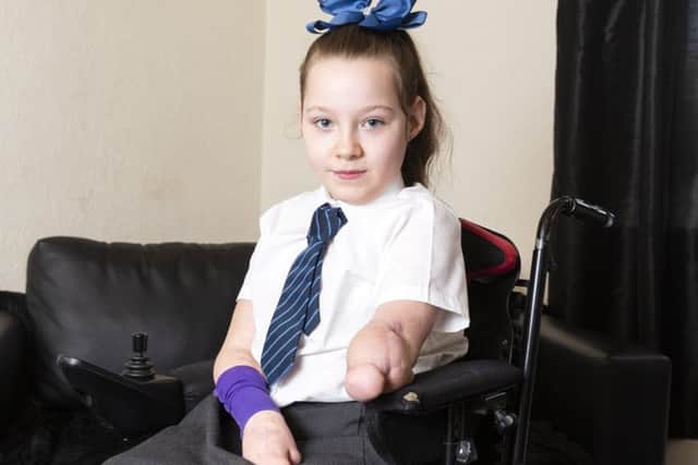 Amputee Rinae Hedgecock, 9, contracted meningitis as a five-year-old. Picture: SWNS