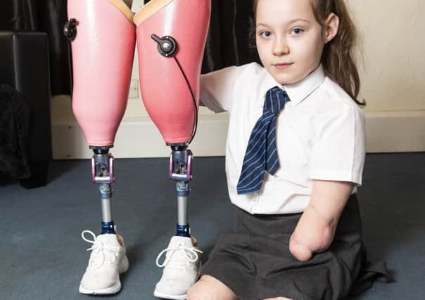 Rinae pictured with her prosthetic legs. Picture: SWNS